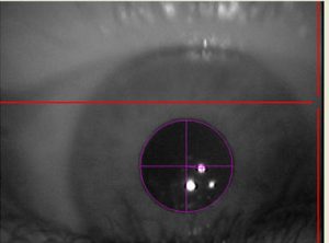 Pupille reflektiert Muster des Eye Trackers